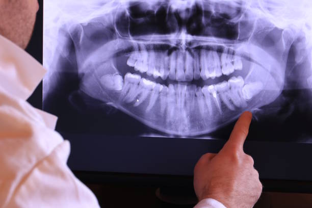 Best Teeth Whitening  in Posen, IL